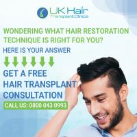 UK Hair Transplant Clinics image 6